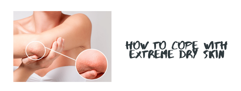 How To Cope With Extreme Dry Skin